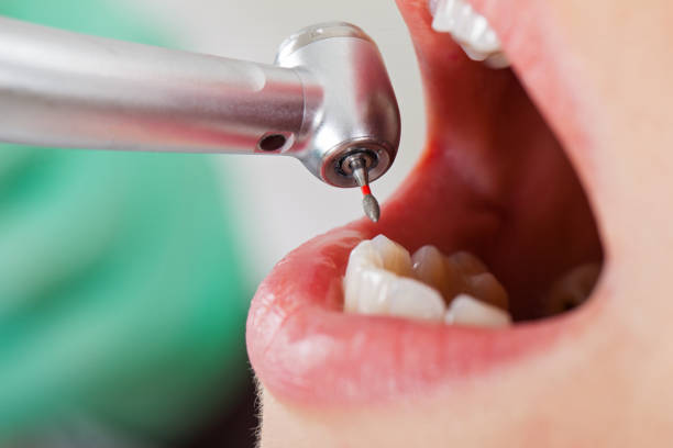 Best Emergency Orthodontic Repairs in Parkville, MD